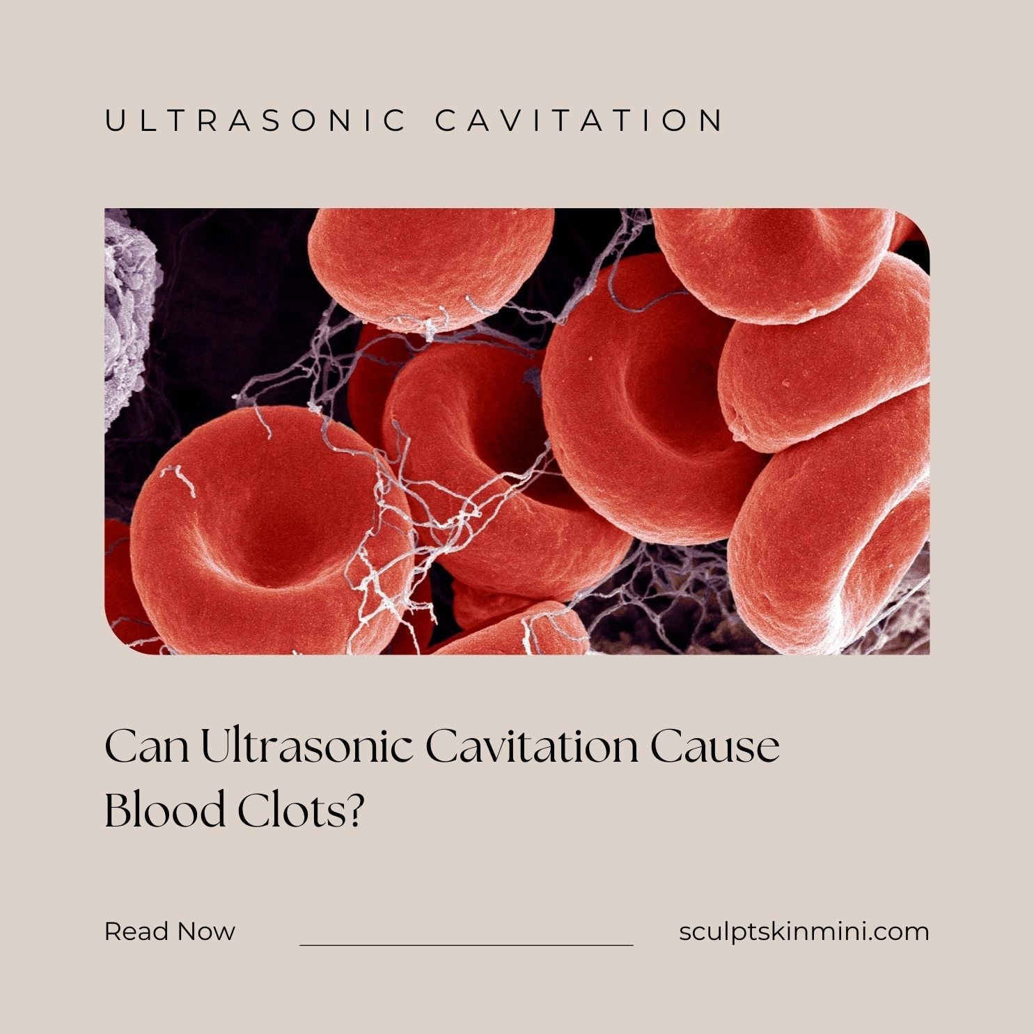 Ultrasonic Cavitation and Blood Clots What You Need to Know SculptSkin