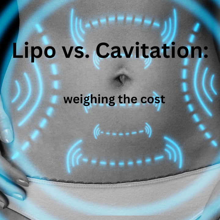 Weighing the Cost: Traditional Liposuction vs. Ultrasonic Cavitation Machine - SculptSkin