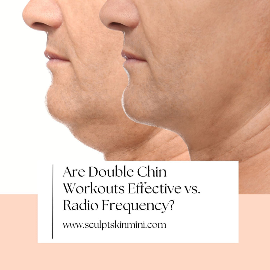 Are Double Chin Workouts Effective vs. Radio Frequency? - SculptSkin