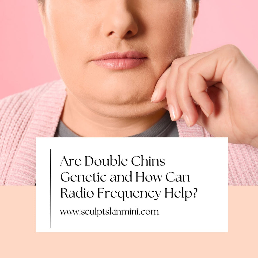 Are Double Chins Genetic and How Can Radio Frequency Help? - SculptSkin