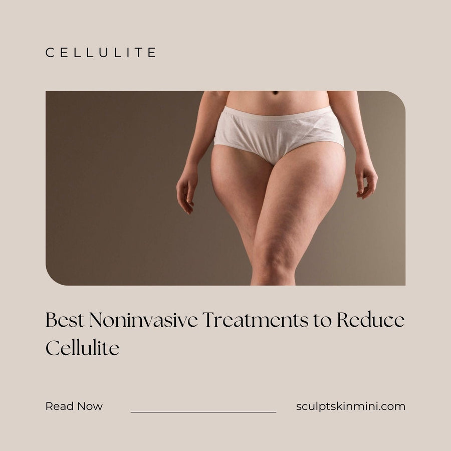 Best Noninvasive Treatments to Reduce Cellulite - SculptSkin
