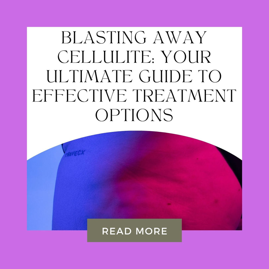 Blasting Away Cellulite: Your Ultimate Guide to Effective Treatment Options - SculptSkin