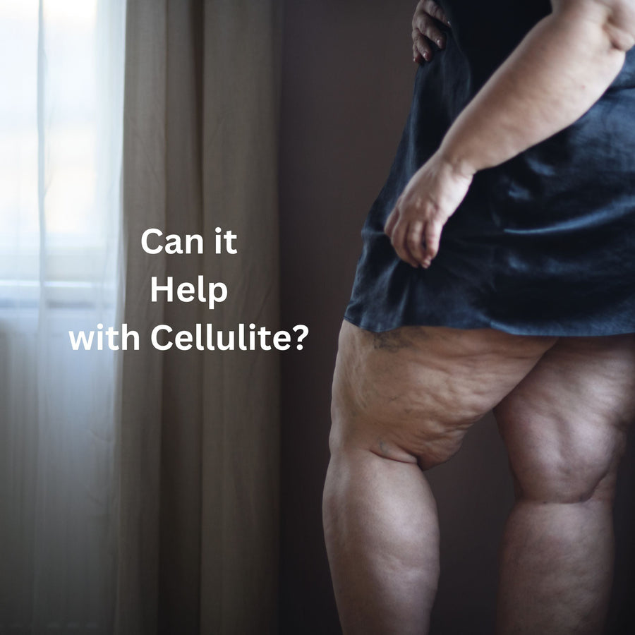 Can Ultrasonic Cavitation Help with Cellulite? - SculptSkin