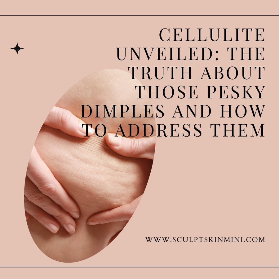 Cellulite Unveiled: The Truth About Those Pesky Dimples and How to Address Them - SculptSkin