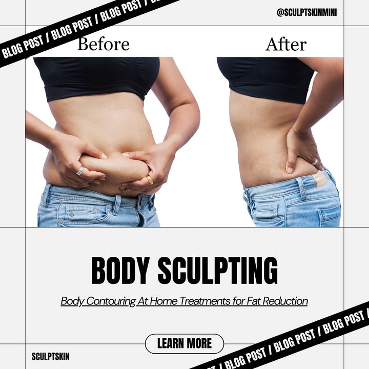 Cosa causa la cellulite? Una spiegazione scientifica - SculptSkin