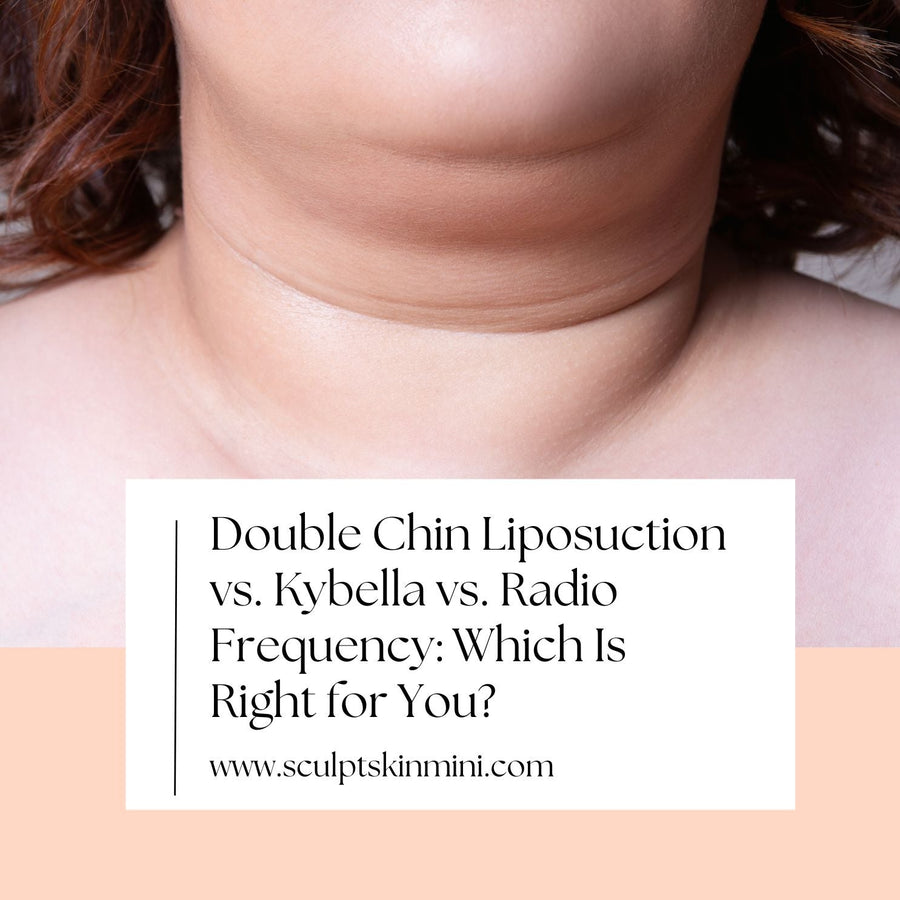 Double Chin Liposuction vs. Kybella vs. Radio Frequency: Which Is Right for You? - SculptSkin