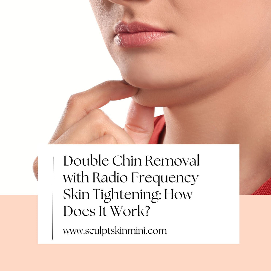 Double Chin Removal with Radio Frequency Skin Tightening: How Does It Work? - SculptSkin