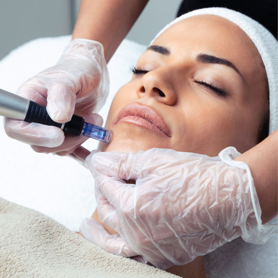 Exploring the Benefits of Microneedling for Volume Loss - SculptSkin