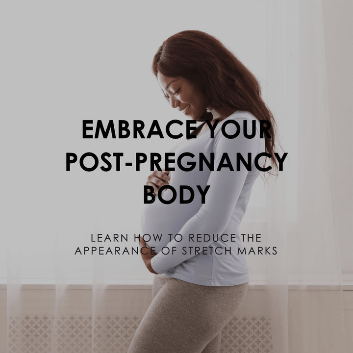 From Tiger Stripes to Silken Threads: Reducing Post-Pregnancy Stretch Marks - SculptSkin