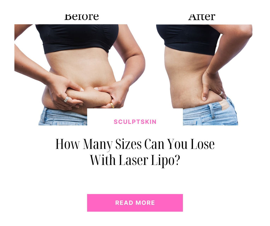How Many Sizes Can You Lose With Laser Lipo? - SculptSkin
