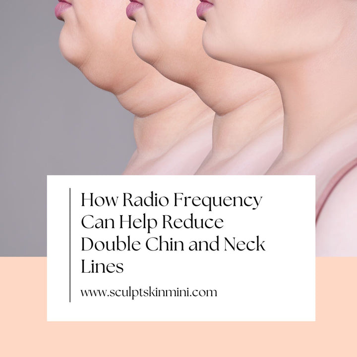 How Radio Frequency Can Help Reduce Double Chin and Neck Lines - SculptSkin