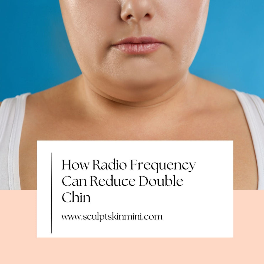 How Radio Frequency Can Reduce Double Chin - SculptSkin