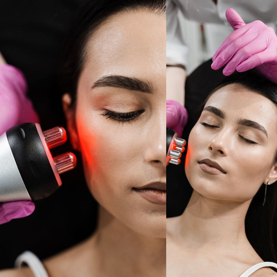 How Radio Frequency Technology Works in Skincare Treatments - SculptSkin