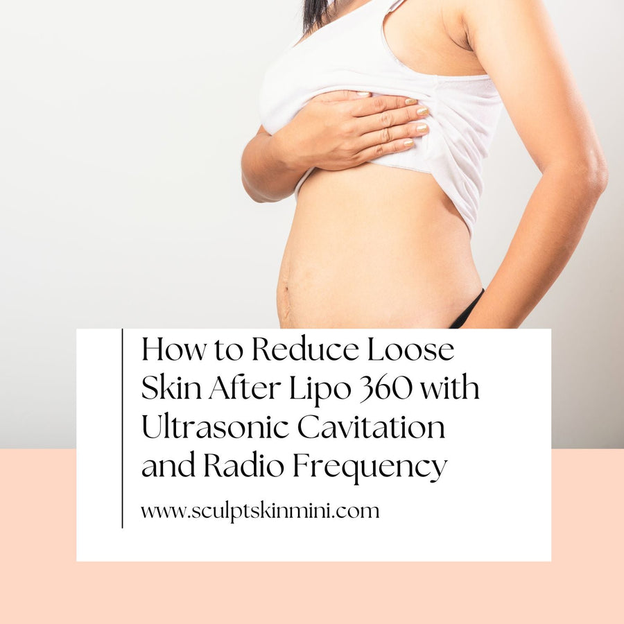 How to Reduce Loose Skin After Lipo 360 with Ultrasonic Cavitation and Radio Frequency - SculptSkin