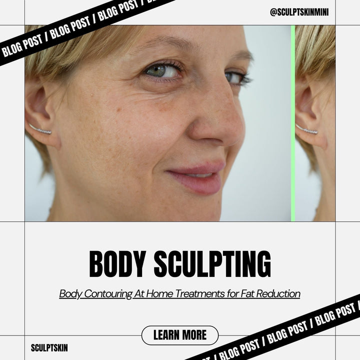 Il Radio Frequency Skin Tightening: Il Tuo Alleato Segreto Contro le Rughe degli Occhi - SculptSkin