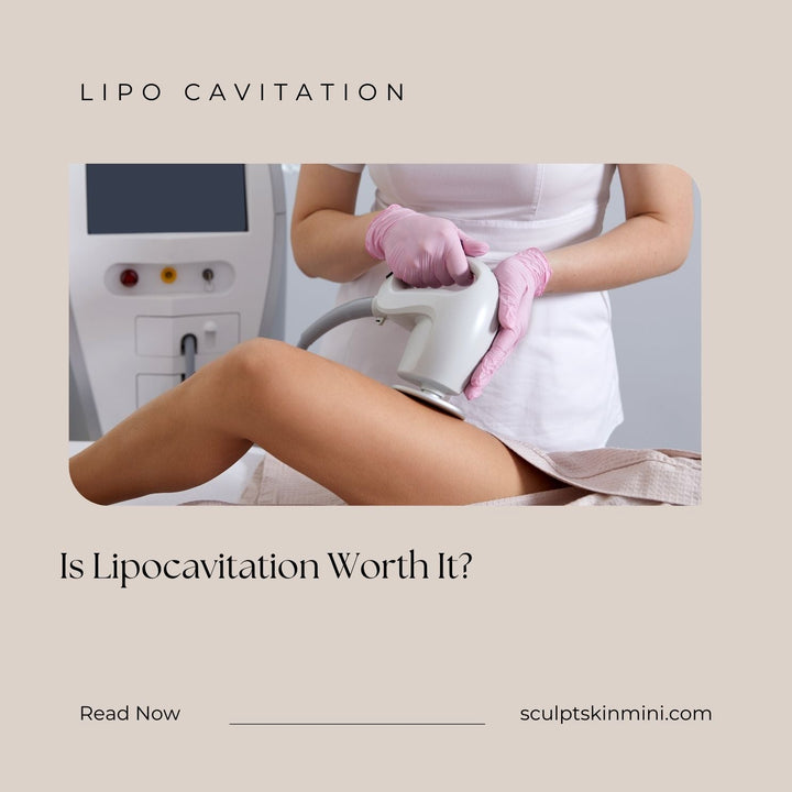 Is Lipocavitation Worth It? - SculptSkin