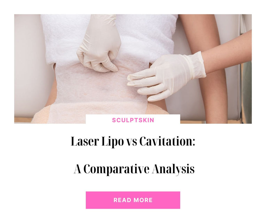 Laser Lipo vs Cavitation: A Comparative Analysis - SculptSkin
