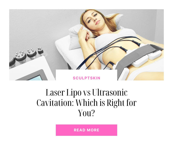 Laser Lipo vs Ultrasonic Cavitation: Which is Right for You? - SculptSkin