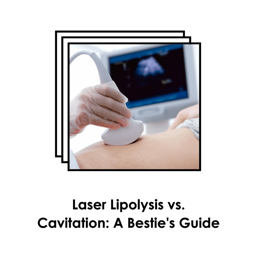 Laser Lipolysis vs. Cavitation: A Bestie's Guide to Making the Right Choice - SculptSkin