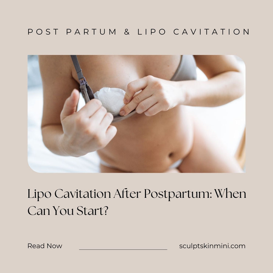 Lipo Cavitation After Postpartum: When Can You Start? - SculptSkin