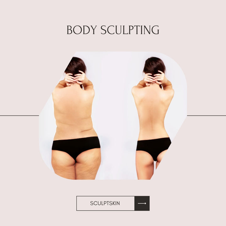 Lipocavitación vs. Criolipólisis: Por qué la Lipocavitación es la Mejor Opción para la Reducción de Grasa - SculptSkin