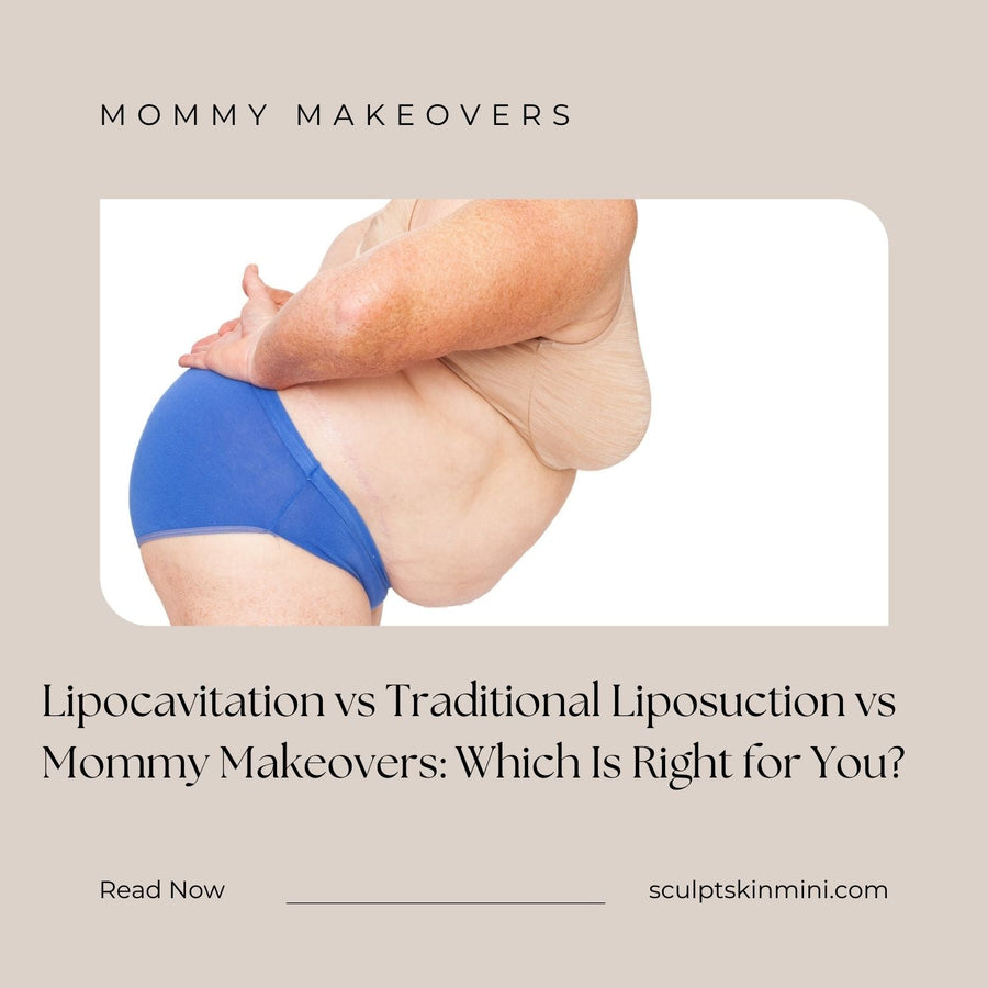 Lipocavitation vs Traditional Liposuction vs Mommy Makeovers: Which Is Right for You? - SculptSkin
