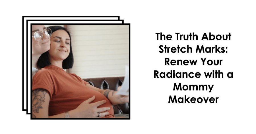 Mommy Makeovers: The Truth About Stretch Marks and Renewed Radiance - SculptSkin