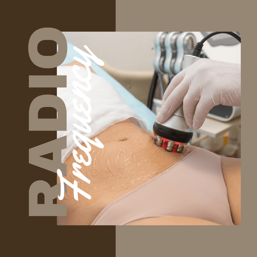 Radio Frequency Skin Tightening: The Ultimate Guide to Turning Back the Clock - SculptSkin
