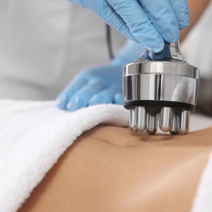 Radio Frequency Treatments: What to Expect During and After - SculptSkin