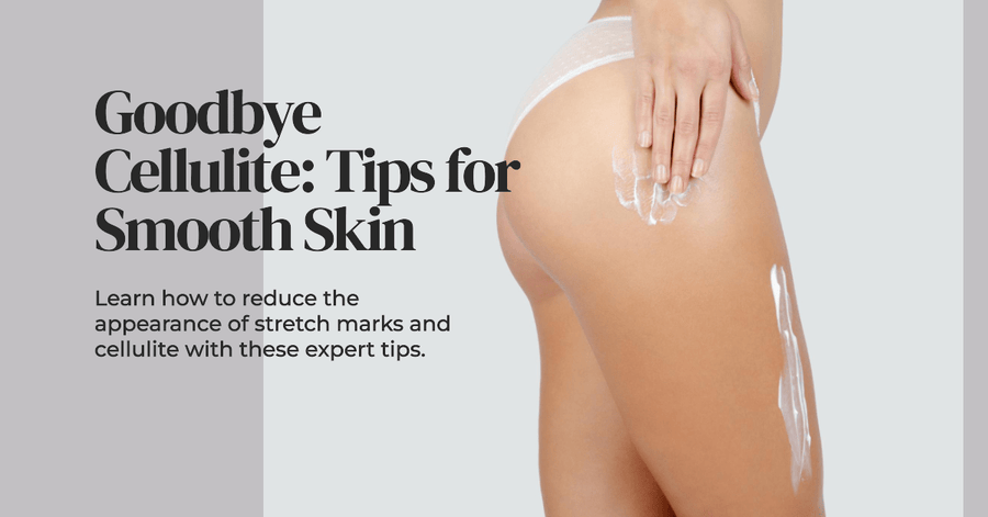 Saying Goodbye to Stretch Marks: Tips for Cellulite Reduction - SculptSkin