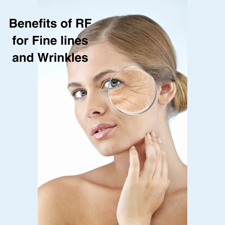 The Benefits of Radio Frequency Skin Tightening for Fine Lines and Wrinkles - SculptSkin