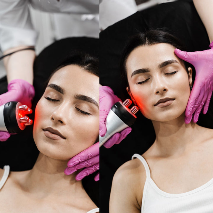 The Evolution of Radio Frequency Technology in Cosmetic Procedures - SculptSkin