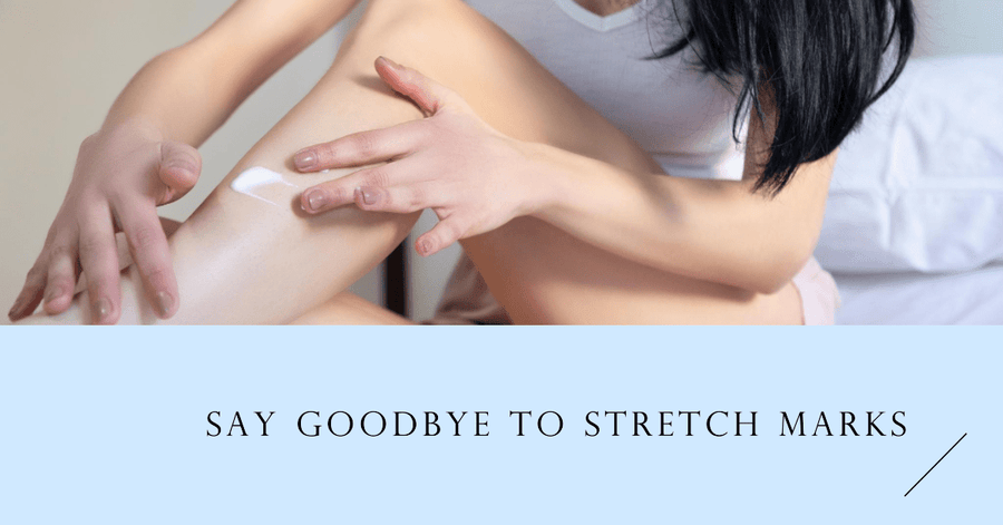 The Ultimate Guide to Stretch Mark Removal - SculptSkin