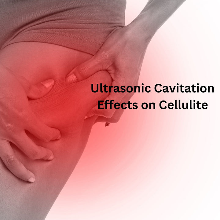 Ultrasonic Cavitation and Its Effects on Cellulite Reduction - SculptSkin