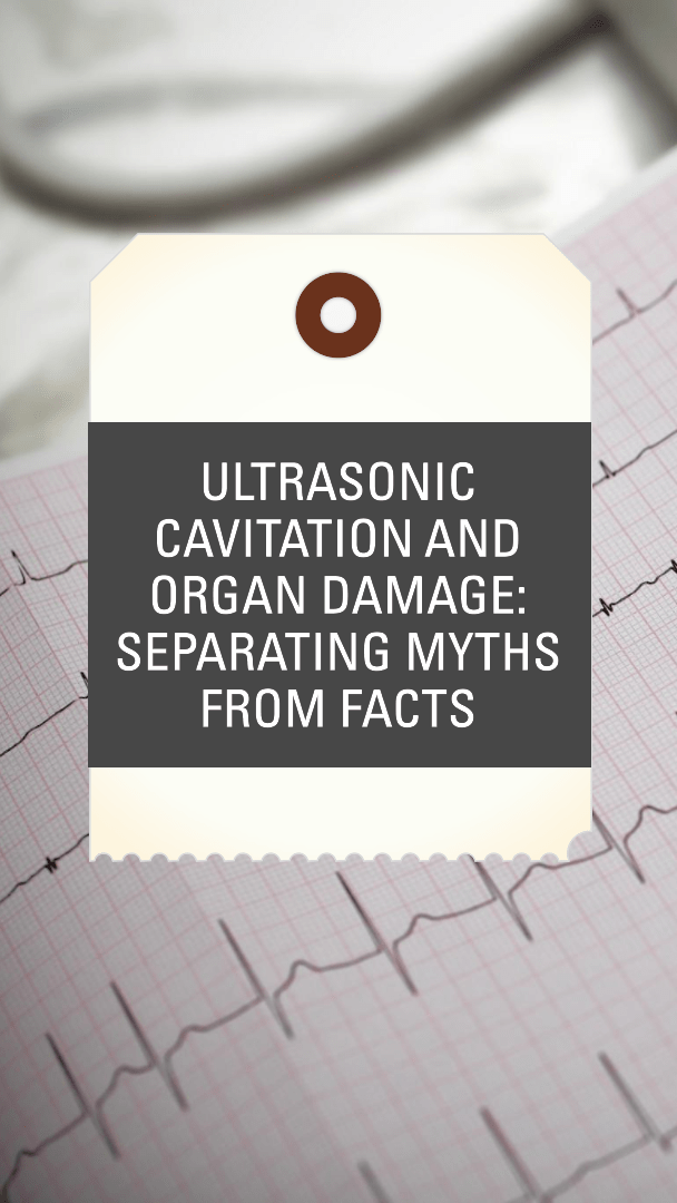Ultrasonic Cavitation and Organ Damage: Separating Myths from Facts - SculptSkin