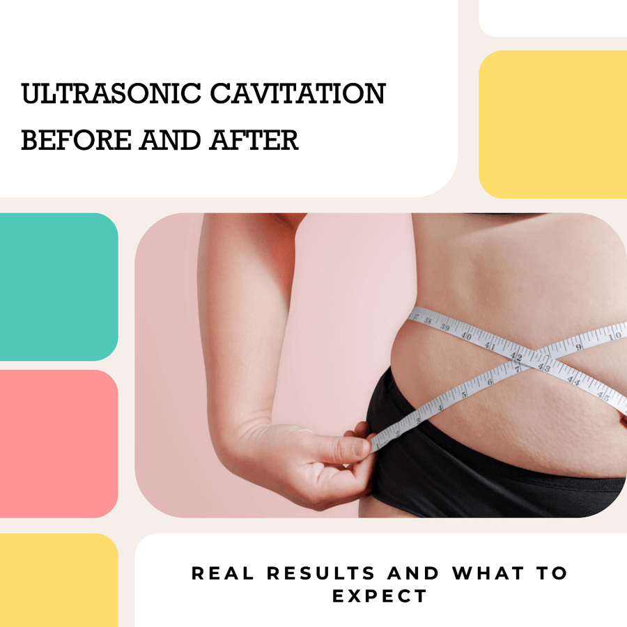 Ultrasonic Cavitation Before and After: Real Results and What to Expect - SculptSkin