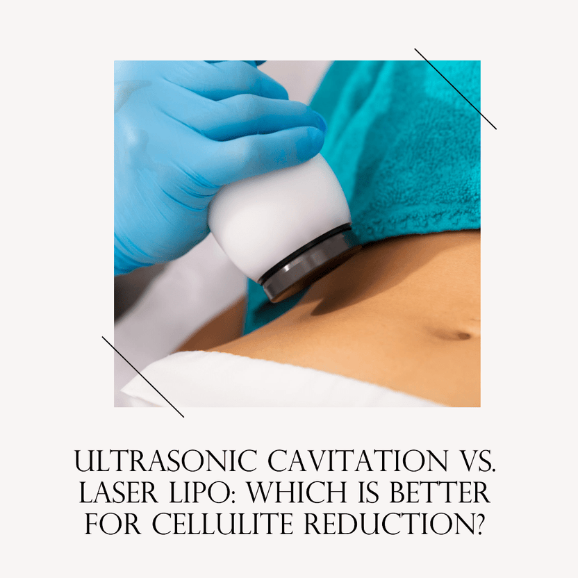 Ultrasonic Cavitation vs. Laser Lipo | SculptSkin