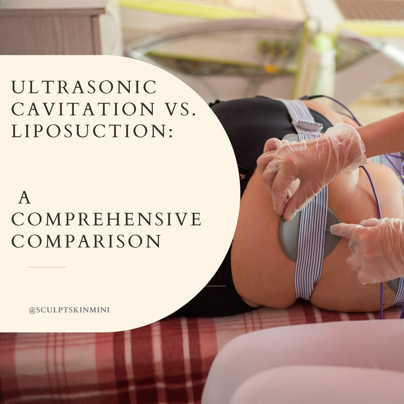 Ultrasonic Cavitation vs. Liposuction A Comprehensive Comparison
