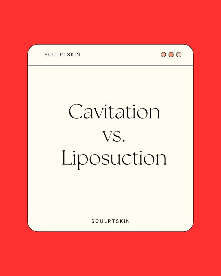 Ultrasonic Cavitation vs. Liposuction: Unveiling the Similarities and Differences - SculptSkin