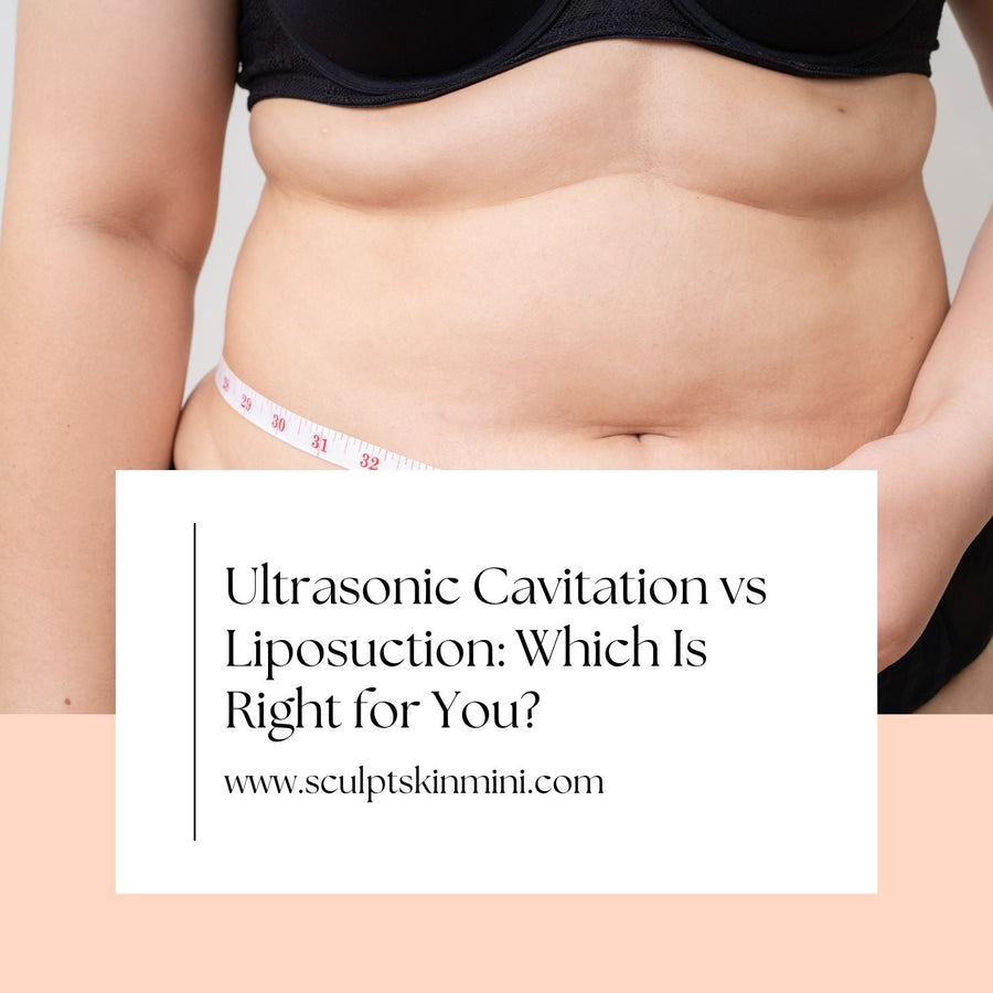 Ultrasonic Cavitation vs Liposuction: Which Is Right for You? - SculptSkin