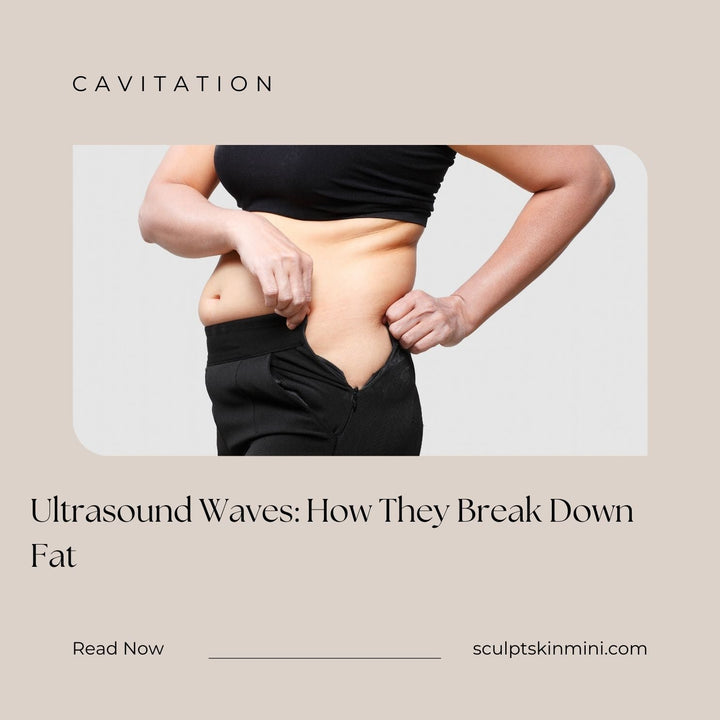 Ultrasound Waves: How They Break Down Fat - SculptSkin