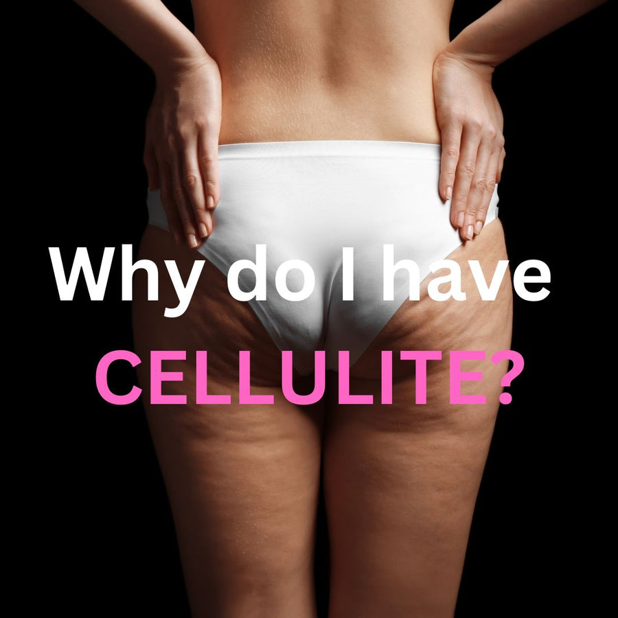 Understanding Cellulite Growth and Combatting it with the SculptSkin Mini - SculptSkin