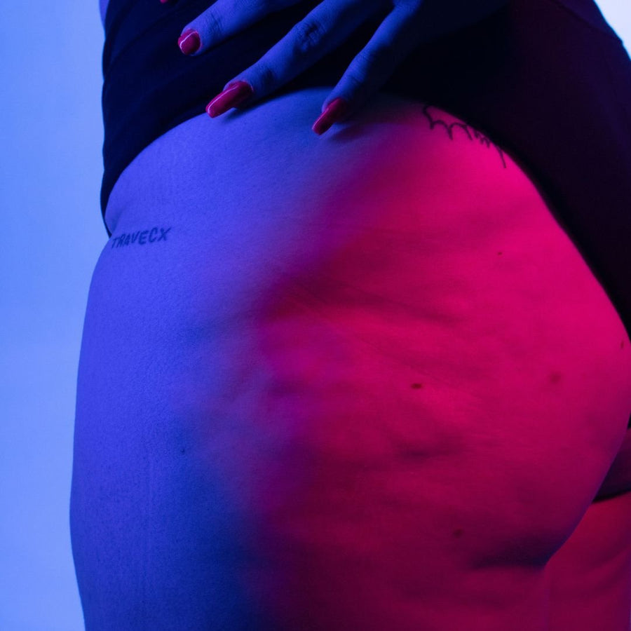 Understanding the Primary Cause of Cellulite and Mitigating Its Appearance with Ultrasonic Cavitation - SculptSkin