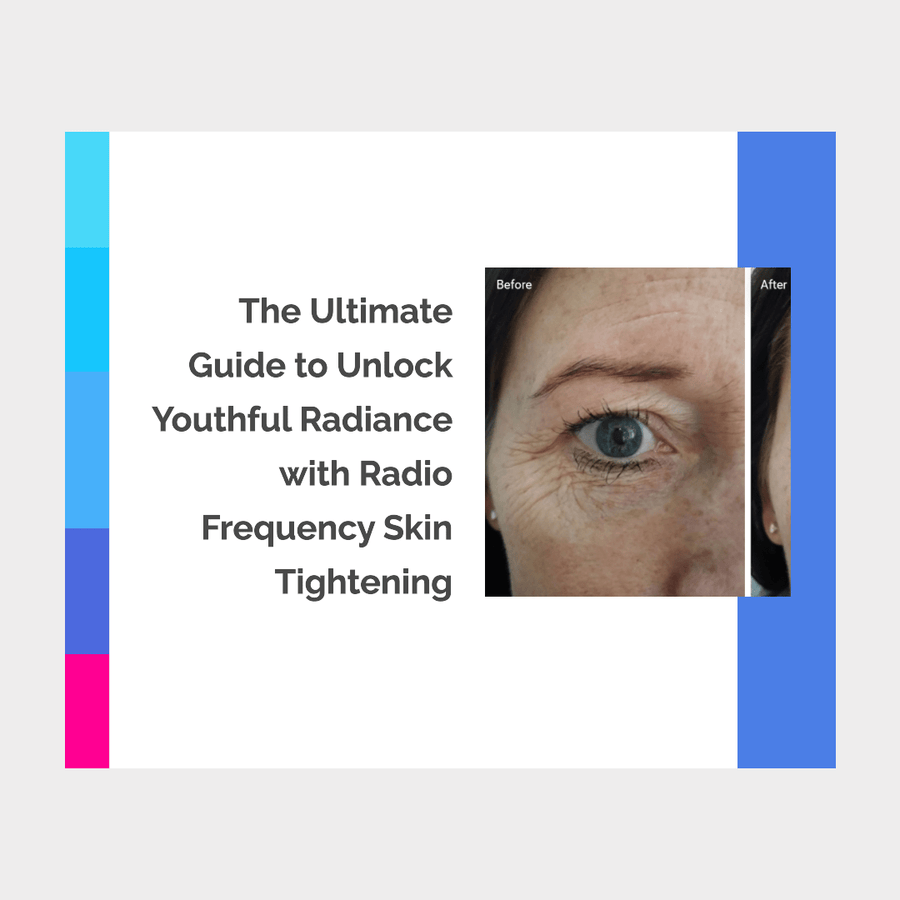 Unlock Youthful Radiance with Radio Frequency Skin Tightening: The Ultimate Guide to Firmer, Smoother, and Age-Defying Skin - SculptSkin