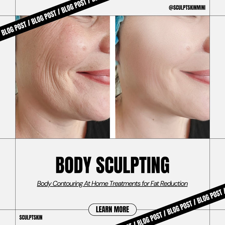 What Causes a Double Chin? A Comprehensive Guide - SculptSkin