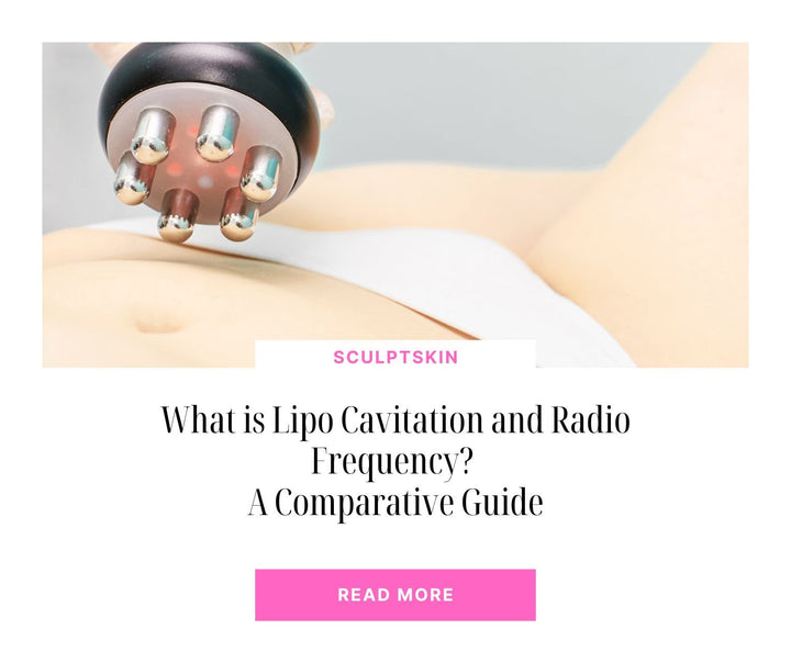 What is Lipo Cavitation and Radio Frequency? A Comparative Guide - SculptSkin