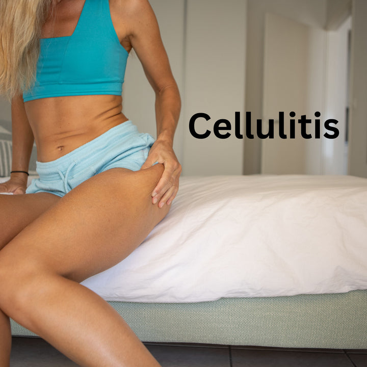 When to See a Doctor for Cellulitis: Recognizing Serious Symptoms - SculptSkin