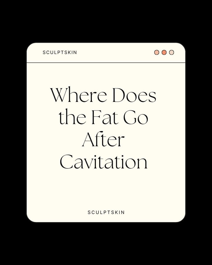 Where Does the Fat Go After Ultrasonic Cavitation? A Journey from Cell to Elimination - SculptSkin