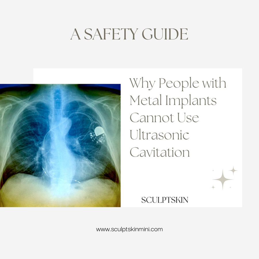 Why People with Metal Implants Cannot Use Ultrasonic Cavitation: A Safety Guide - SculptSkin