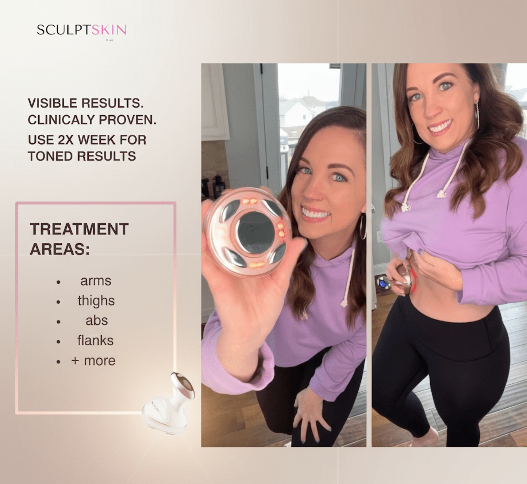 SculptSkin™ Body Sculpting - SculptSkin